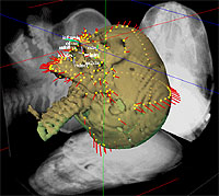 Visualization of the average skull shape and size in a group of 42 children with unilateral incomplete cleft lip at the age of 2 months (surface and three-projection x-rays) and average growth to 22 months of age (red vectors).